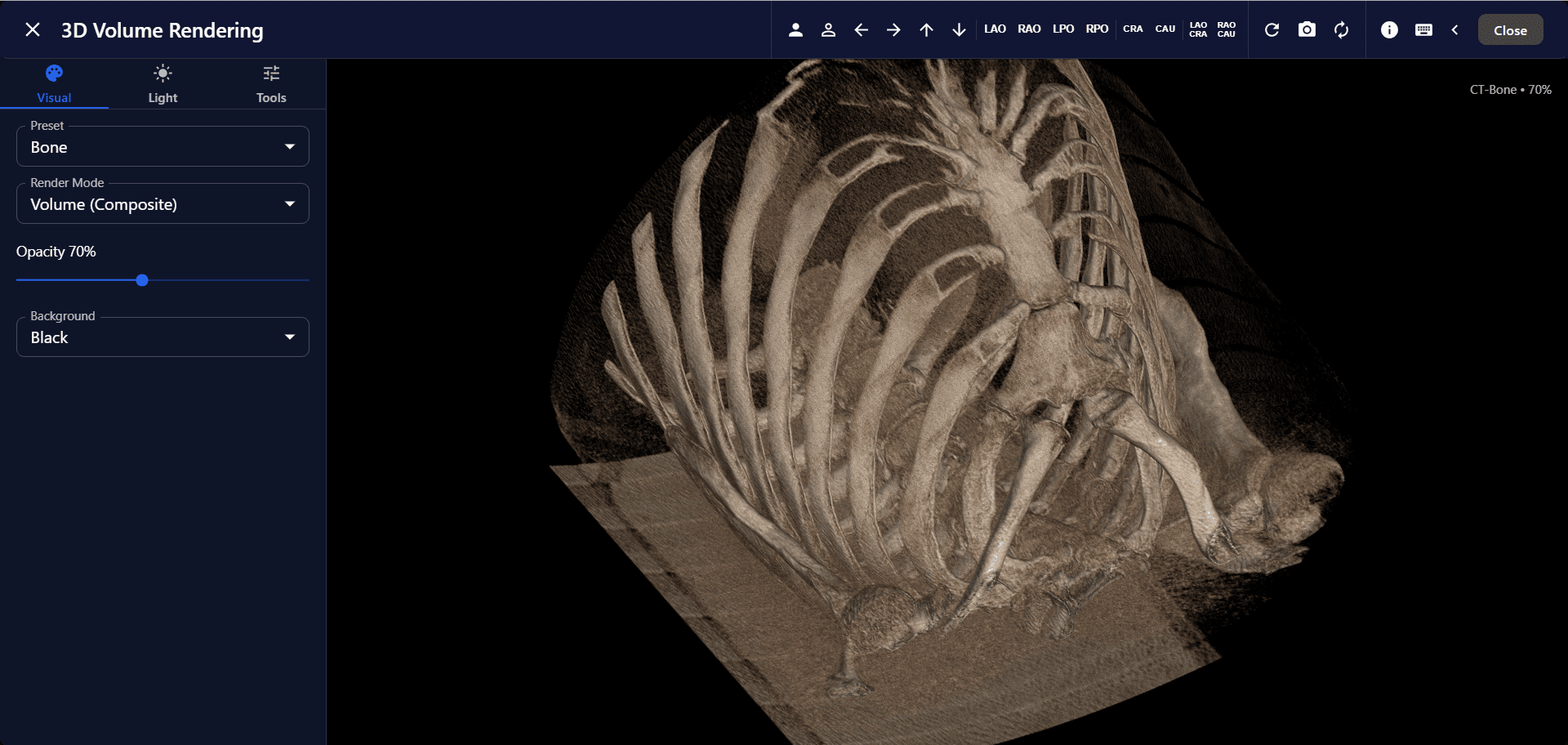 Radiyx DICOM viewer displaying 3D volume rendering capabilities