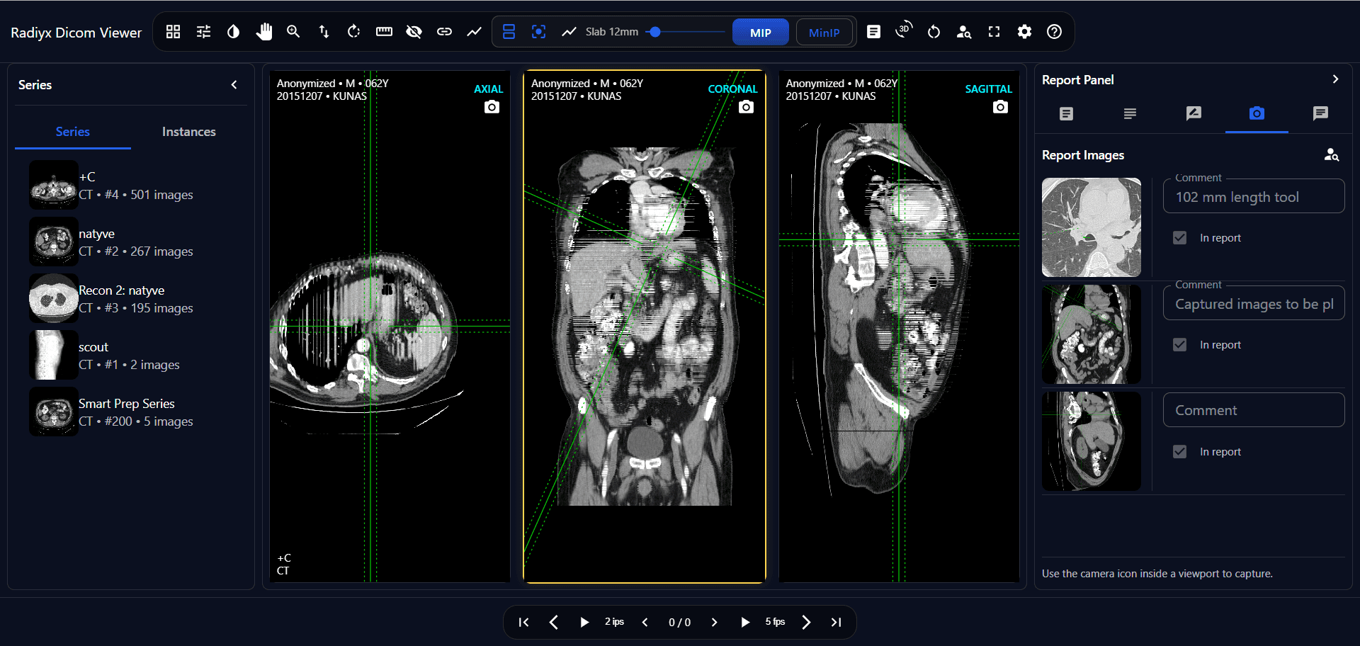 Radiyx web DICOM viewer showing MPR visualization and integrated workflow context
