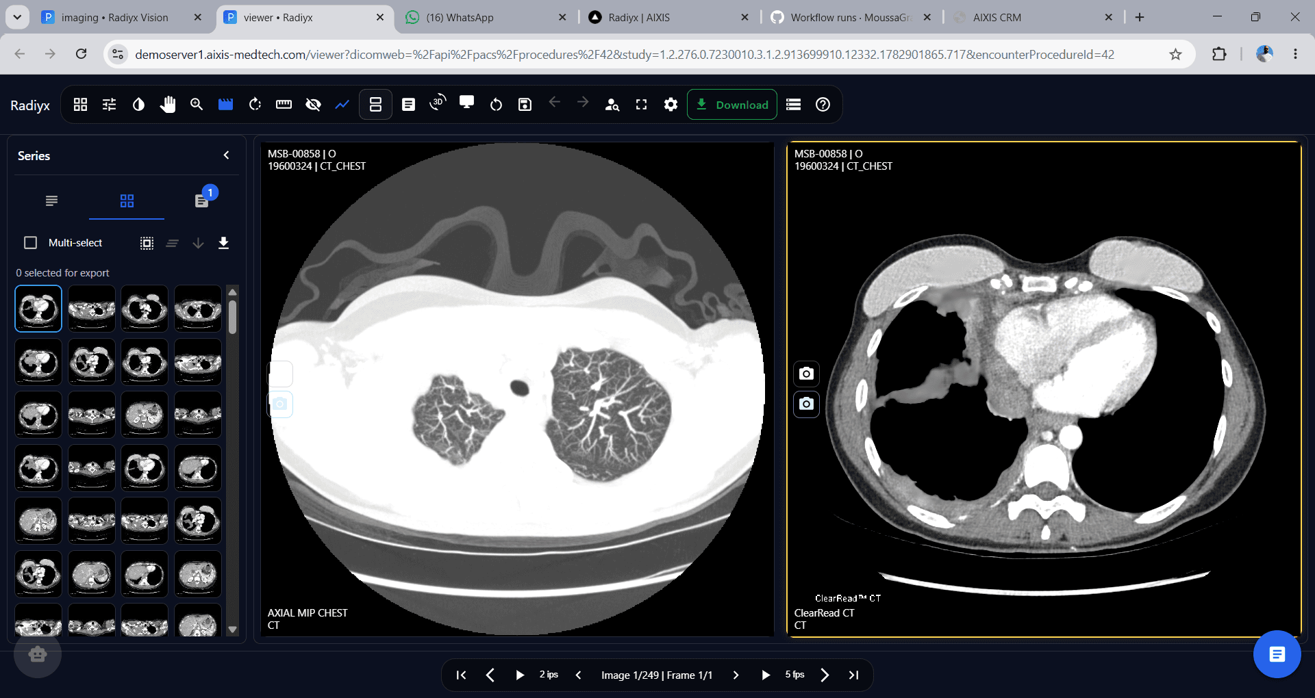 Radiyx View interface screenshot