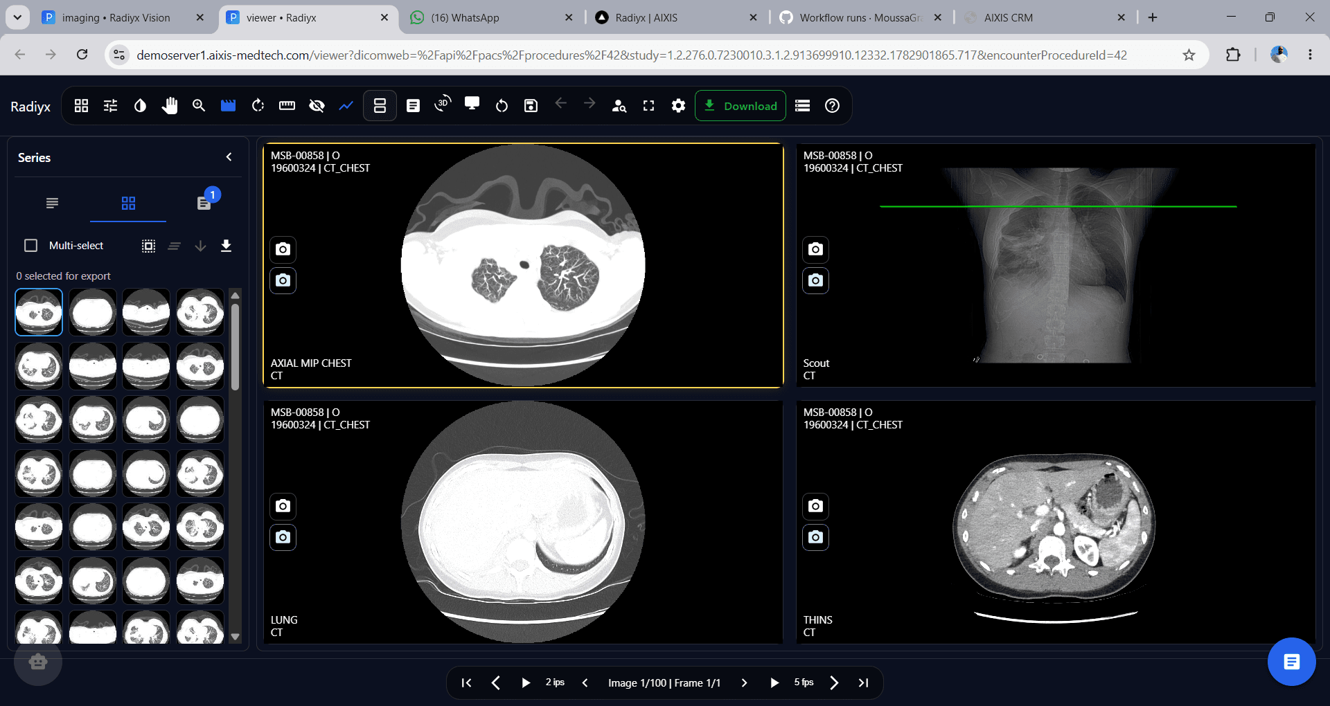 Radiyx View interface screenshot