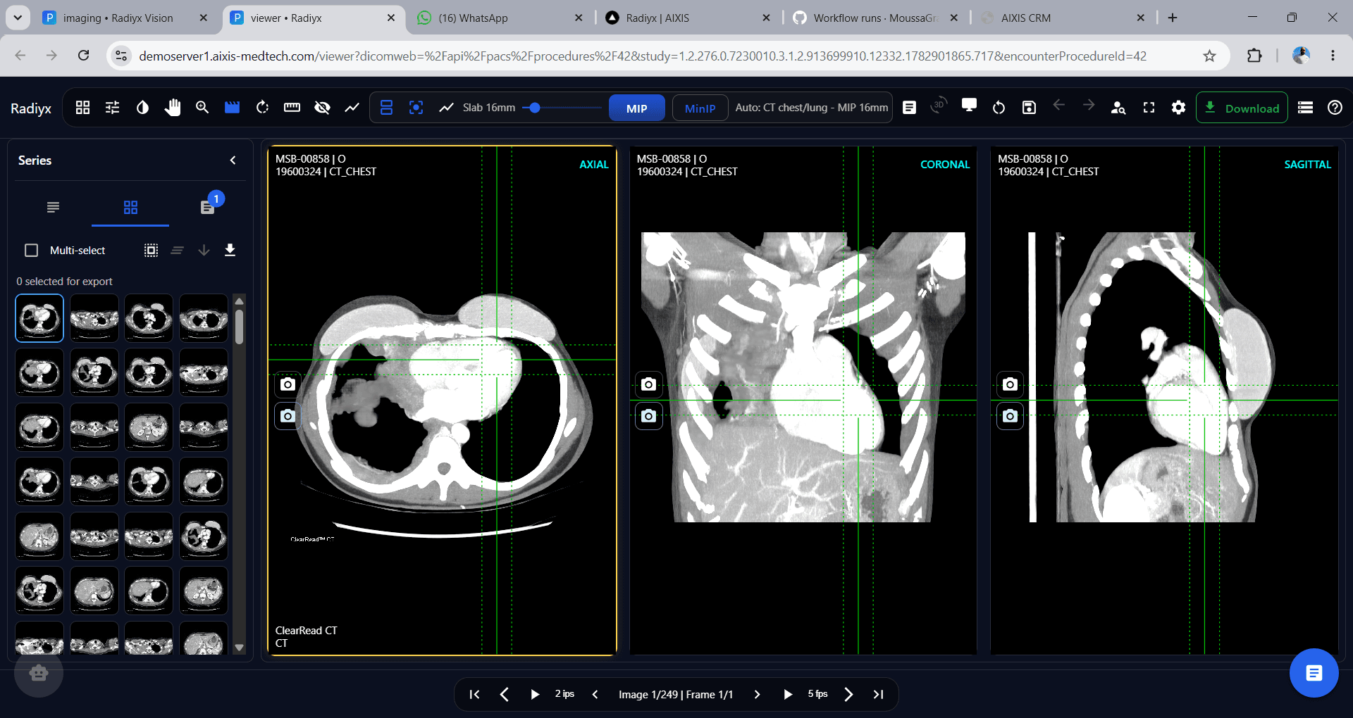 Radiyx View interface screenshot