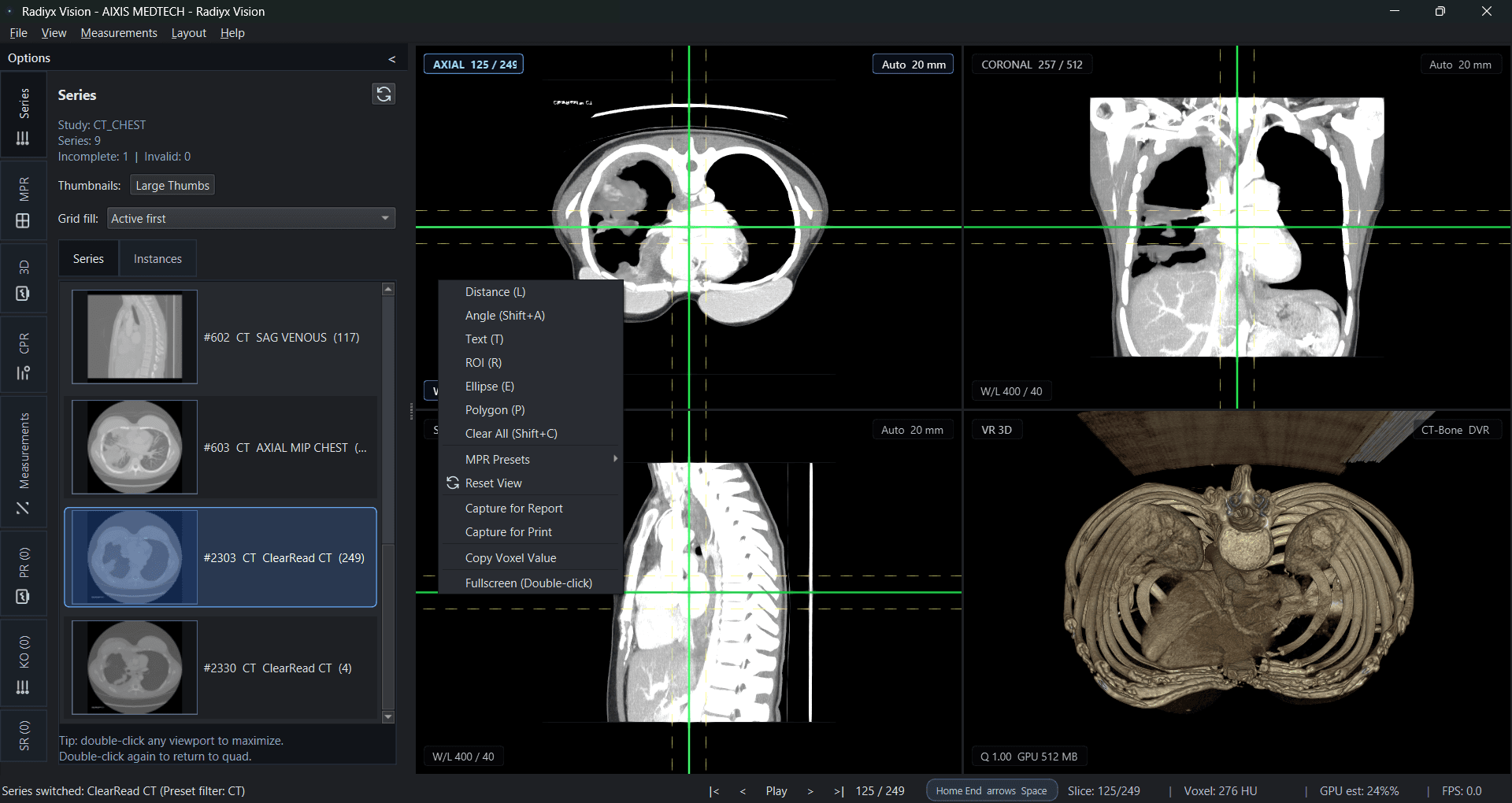 Radiyx Vision interface screenshot
