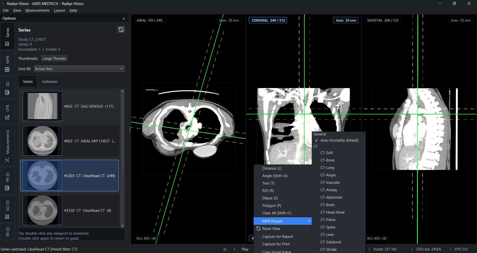 Radiyx Vision interface screenshot